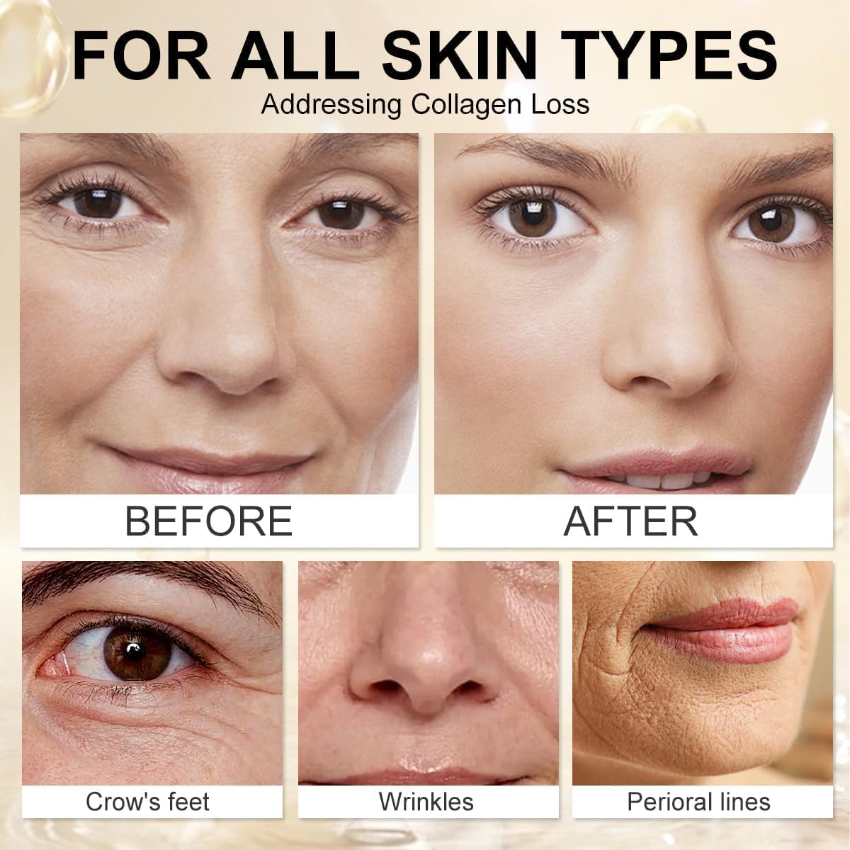 Botox Bee Venom Wrinkle Removal Cream