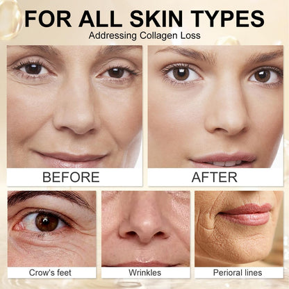 Botox Bee Venom Wrinkle Removal Cream