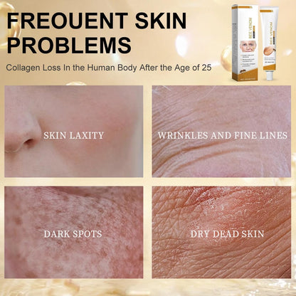 Botox Bee Venom Wrinkle Removal Cream