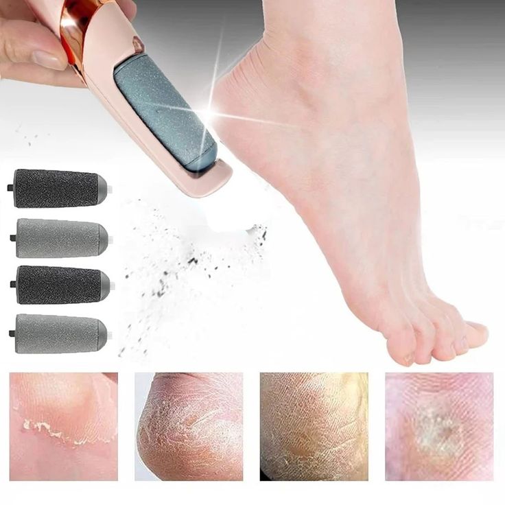Electric Pedicure Foot File Callus Remover